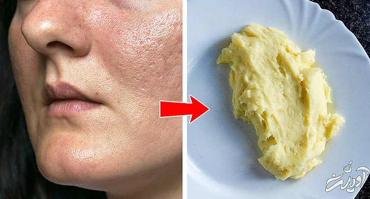 ۱۱ پیشنهاد برای خوشگلی و حفظ جذابیت در زنان